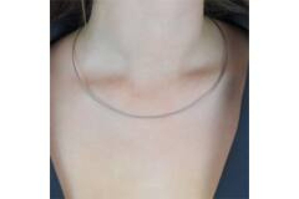 boccia-titanium-0804-01-elegante-damesketting-met-bajonetsluiting